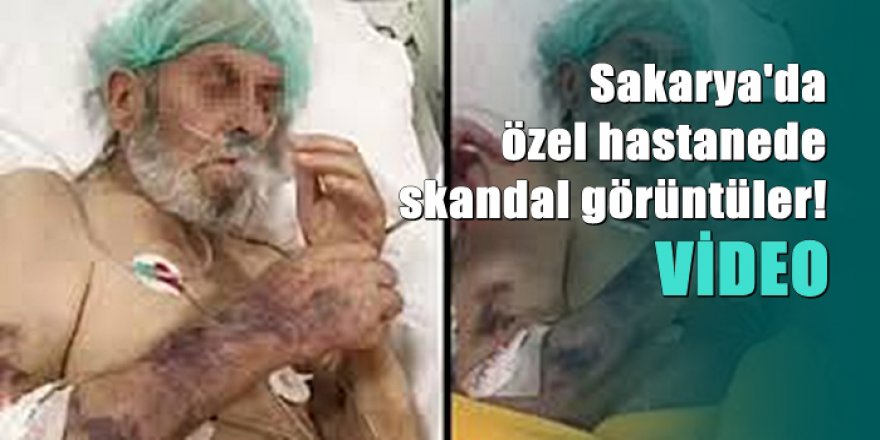 Yoğun Bakım hastasına sigara verip, dalga geçtiler