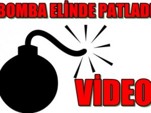 Elinde bomba patladı