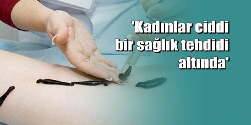 Sağlıkta gelinen yeni nokta: Vajinal sülük tedavisi!