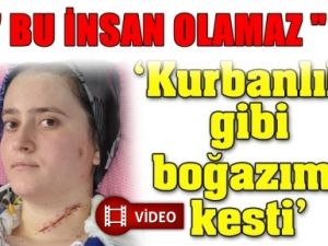 Boğazımı Kurban keser Gibi kesti