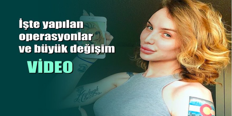 Kylie Jenner'a benzemek için 75.000 dolar harcayan trans genç