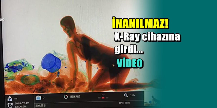 Çin'de bir kadın X-Ray cihazına girdi