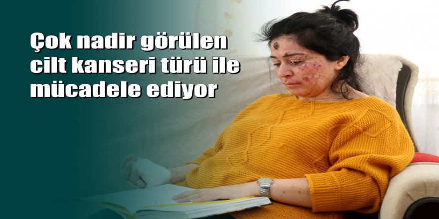 Antalya'da Sibel Oflas'ın hastalığını fırsata çevirmek istediler