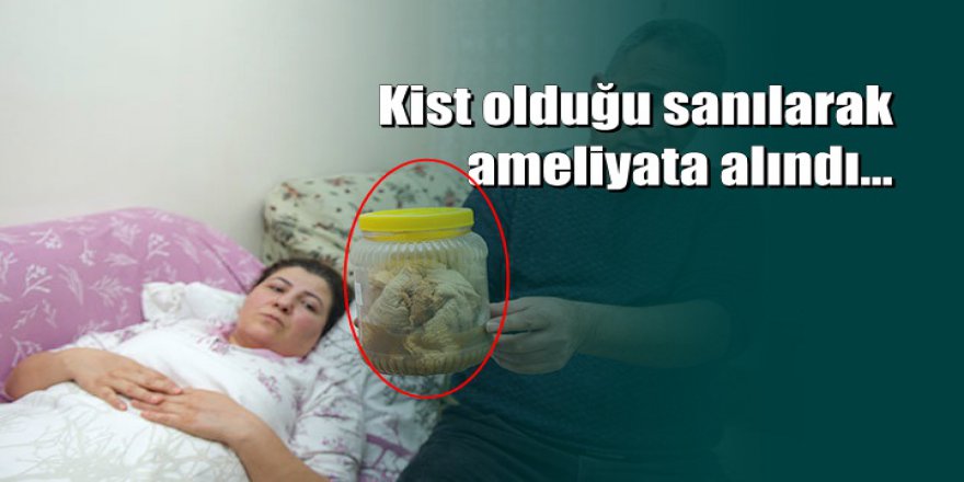 'Kanser olabilirsin' denildi, karnından kavanoz dolusu gazlı bez çıktı