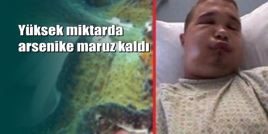 Şaka olsun diye cinsel organını istiridyeye soktu hastanelik oldu