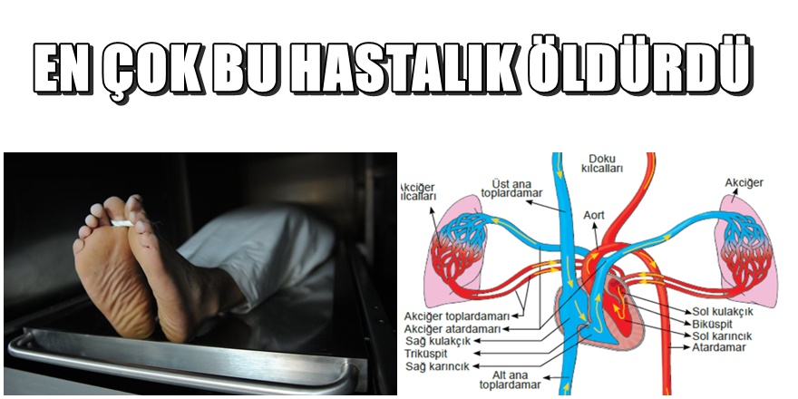 Türkleri en çok öldüren hastalık açıklandı