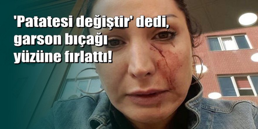 Antalya'da restoran korkunç olay: Garson bıçağı yüzüne fırlattı