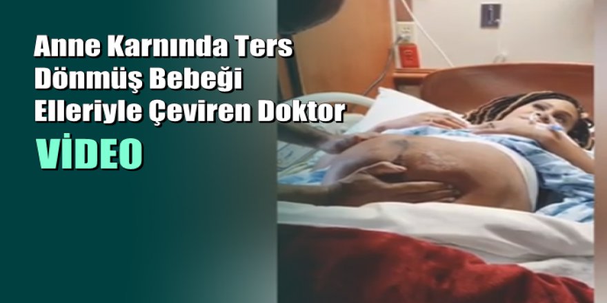 Anne Karnında Ters Dönmüş Bebeği Elleriyle Çeviren Doktor