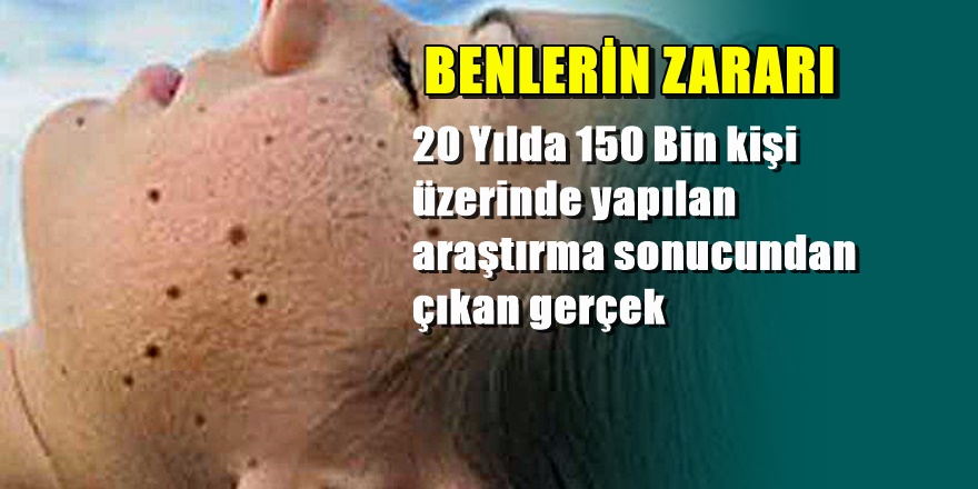 Vücudunda 5'ten fazla ben olan okusun