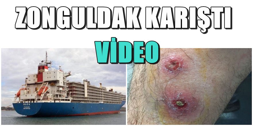 Zonguldak'ta şarbon paniği