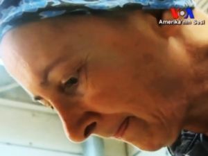 Meme Kanseri Tedavisinde Farklı Yöntemler