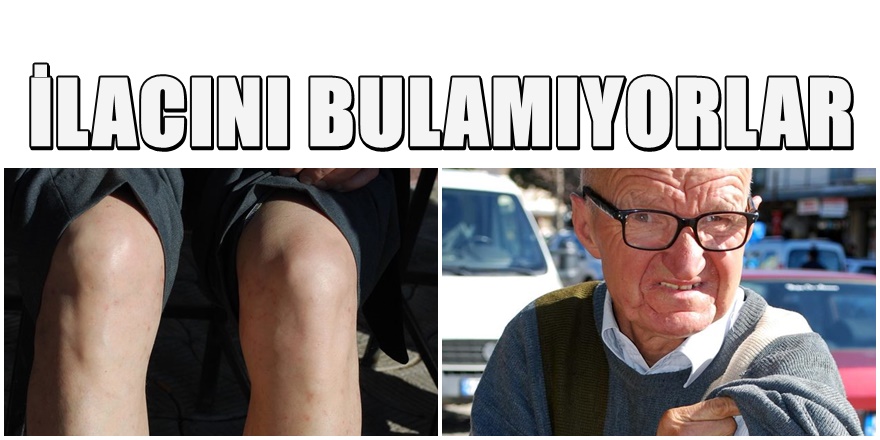 Manisa'da Uyuz Salgını Önlenemiyor